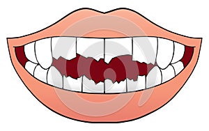Mouth Full of Broken Teeth photo