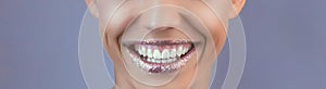 Perfect teeth smile with shiny lips. Beautiful close-up of a tanned face of a young woman with clean fresh skin.