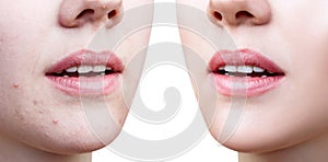 Perfect woman`s lips before and after retouch.