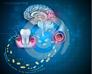 Periodontitis and brain problms photo