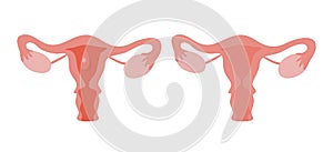 Periods. Menstruation. Modern vector cartoon uterus illusration. photo