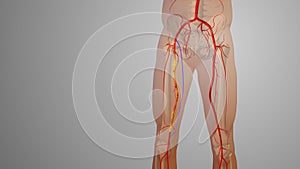 Peripheral artery bypass surgery medical animation