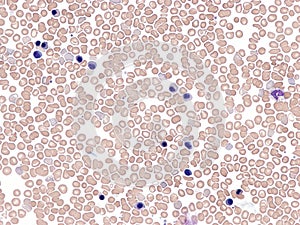 Peripheral blood of a premature newborn.