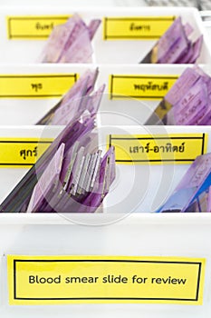 Peripheral Blood Smear (PBS)