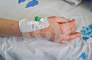 Peripheral intravenous catheter on lower arm