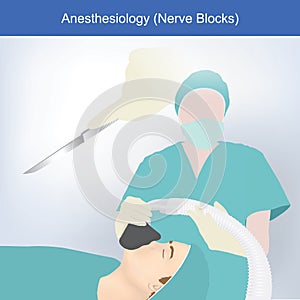 Peripheral neuropathy.  Explain illustration for The Peripheral neuropathy