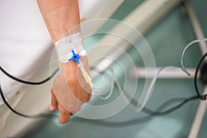 Peripheral venous catheter on the hand of young woman