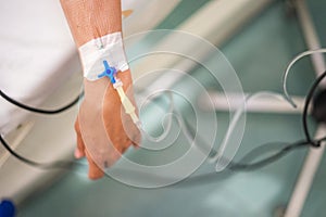 Peripheral venous catheter on the hand of young woman