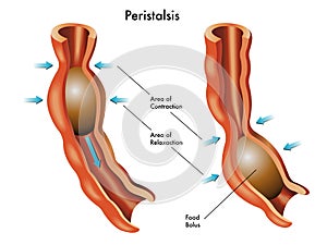 Peristalsis