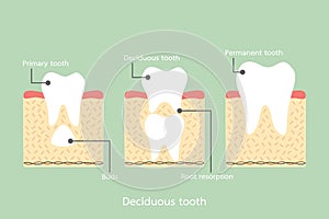Permanent tooth located below primary tooth, anatomy structure including the bone and gum with detail word