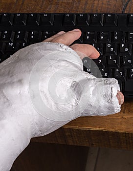 Person with arm cast typing on a keyboard