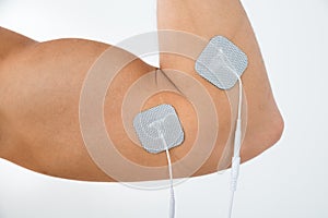 Person biceps with electrostimulator electrodes