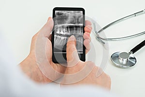 Person with dental x-ray film on mobile phone