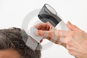 Person With Dermatoscope Examining Patient`s Hair