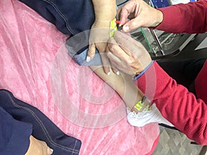 A person is given a bioimpedance medical analysis to diagnose body composition. Sensors are connected to the arm for medical photo