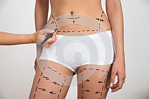 Person hand drawing lines on woman's abdomen and leg