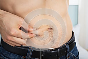 Person Measuring Fat On Belly
