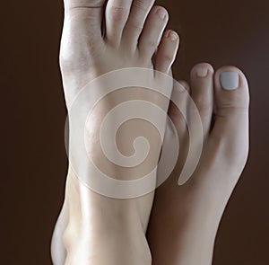 a person's bare feet with no nails on it