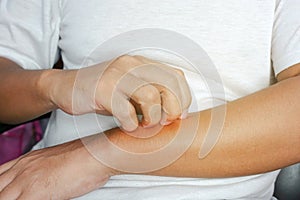 Person scratching at itchy skin on their arms