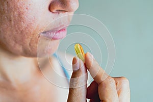 A person taking a medicine pill