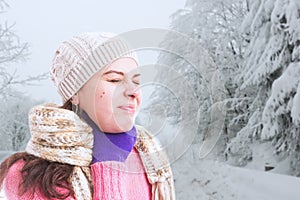 Person touching neck as flue or cold concept