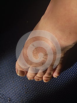 Perspective view of a dirty male foot