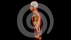 PET CT Scan fusion image It provides detailed images by merging