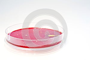 Petri dish