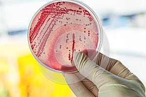 Petri dish with bacteria photo