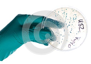 Petri dish with bacterial colonies