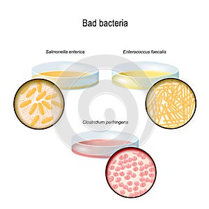 A Petri dish with bacterial colonies. Close-up of bad bacteria: Clostridium, Enterococcus, and Salmonella photo