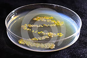 A petri dish with common yeast and bacteria colonies