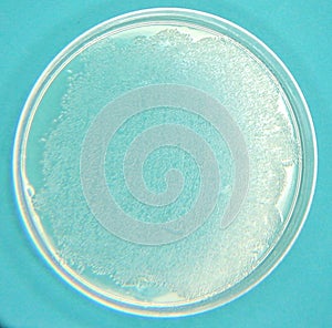 Petri Dish with Ecoli Culture growing