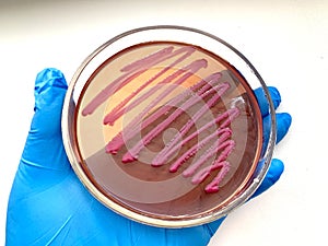Petri dish with enterobacteria. Bacteria colonies culture on selective agar media