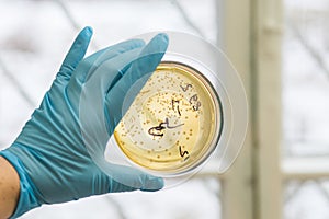 Petri dish with growing bacteria