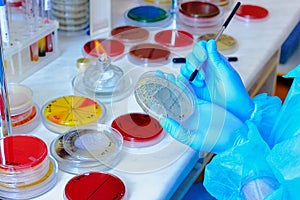 Petri dish. Microbiological laboratory