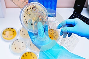 Petri dish. Microbiological laboratory. Mold and fungal cultures. Bacterial research.