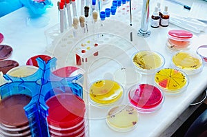 Petri dish. Microbiological laboratory. Mold and fungal cultures. Bacterial research.