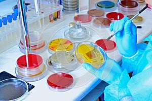 Petri dish. Microbiological laboratory