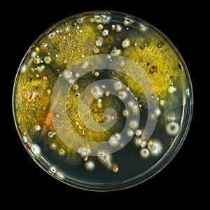 Petri dish with mold