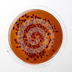 Petri dish with a salmonella colony