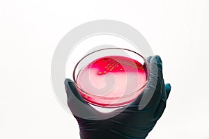 Petri dish with Staphylococcus bacteria in medical laboratory