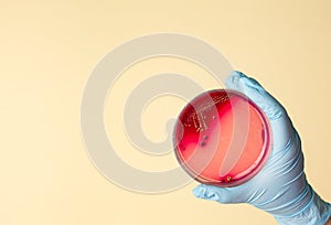 Petri dish with Staphylococcus bacteria in medical laboratory photo