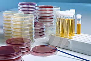 Petri dish and tubes for test of urine culture