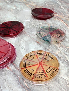 Petri dishes