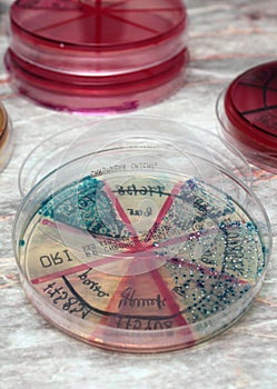 Petri dishes