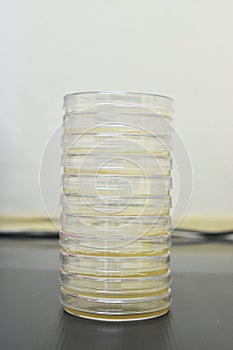 Petri dishes filled with colorful agar growth medium. Medical science equipment