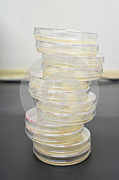 Petri dishes filled with colorful agar growth medium. Medical science equipment