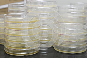 Petri dishes filled with colorful agar growth medium. Medical science equipment