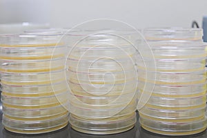 Petri dishes filled with colorful agar growth medium. Medical science equipment